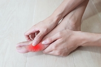 Description of Gout and How Your Diet May Be Fueling It
